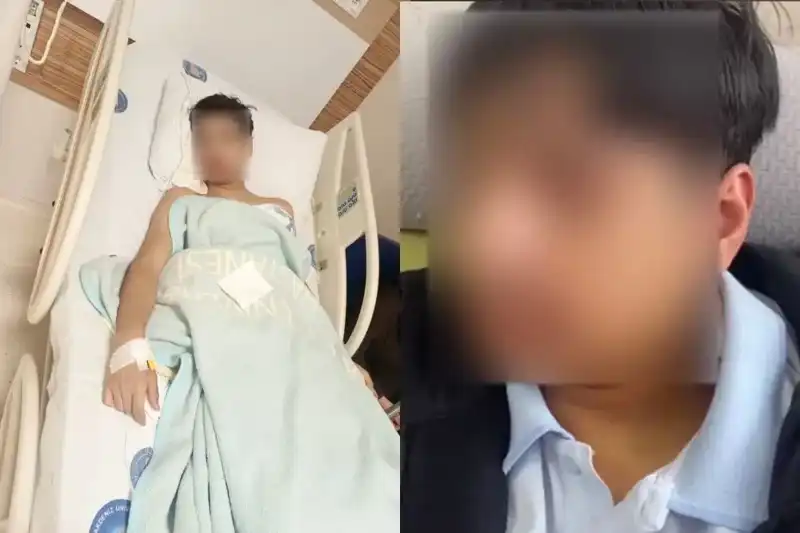 Antalya'da Korkunç Olay: Akran Zorbalığı Neticesinde Çene Kırıldı