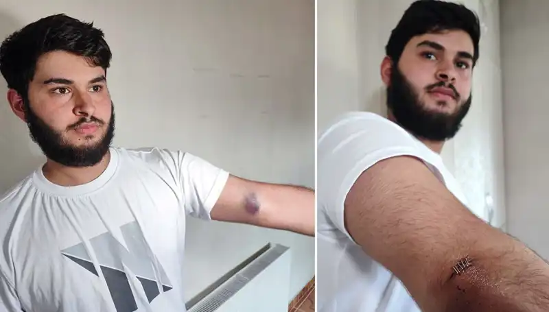 Bahçeye Kaçan Top, Mahallede Renkli Bir Olay Yarattı: "Conolar Kamyonetle Geldi"