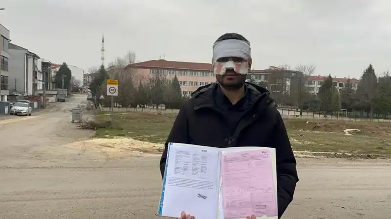 Öğretmen, Meslektaşının Yüzüne Sıcak Çay Fırlattı: Olayın Detayları