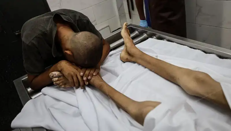 Gazze'de Açlık Krizi: Küçük Bir Hayat Daha Kaybedildi