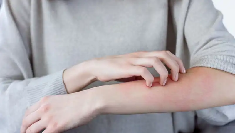 Cilt Kanserinin Gizli Belirtileri: Dermatologdan Uyarılar